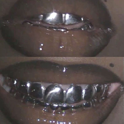 Silver 925 - Gold Plated Grillz